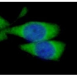 Lipopolysaccharide Binding Protein (LBP) Antibody