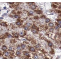 Lipopolysaccharide Binding Protein (LBP) Antibody