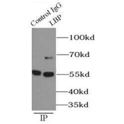 Lipopolysaccharide Binding Protein (LBP) Antibody