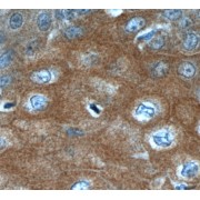 IHC-P analysis of human oesophagus tissue LCE1A antibody (1/50 dilution).