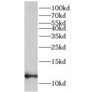 WB analysis of A375 cells, using LCE1B antibody (1/1000 dilution).