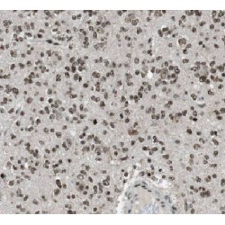 Proto-Oncogene Tyrosine-Protein Kinase LCK (LCK) Antibody