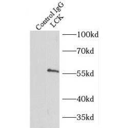 Proto-Oncogene Tyrosine-Protein Kinase LCK (LCK) Antibody