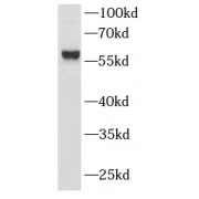 WB analysis of Jurkat cells, using LCK antibody (1/1000 dilution).