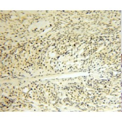 LIM Domain Binding Protein 1 (LDB1) Antibody