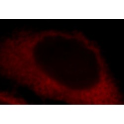 Lactate Dehydrogenase A (LDHA) Antibody