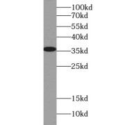 WB analysis of HeLa cells, using LDHA antibody (1/500 dilution).