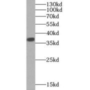 WB analysis of A431 cells, using LDHA-Specific antibody (1/2000 dilution).