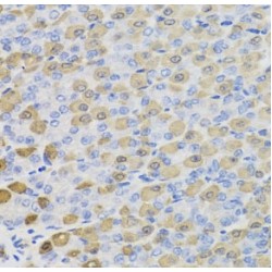 Lactate Dehydrogenase B (LDHB) Antibody