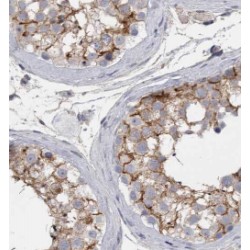 LDHC-Specific Antibody