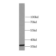 WB analysis of human testis tissue, using LDHC antibody (1/300 dilution).