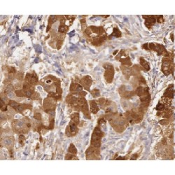 Lactate Dehydrogenase D (LDHD) Antibody