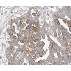 Left/Right Determination Factor 2 (LEFTY2) Antibody