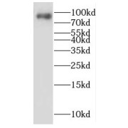 WB analysis of A2780 cells, using LENG8 antibody (1/1200 dilution).