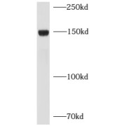 WB analysis of mouse heart tissue, using LEPR antibody (1/1000 dilution).