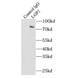 Probable ATP-Dependent RNA Helicase DHX58 (DHX58) Antibody