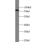 WB analysis of HEK-293 cells, using DHX58 antibody (1/300 dilution).