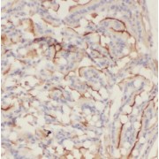 IHC-P analysis of human small intestine tissue LGR4 antibody (1/100 dilution).