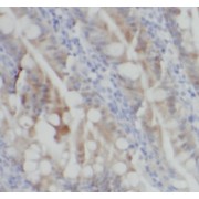 IHC-P analysis of human small intestine tissue, using LGR5 antibody (1/200 dilution).