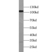WB analysis of mouse testis tissue, using LGR6 antibody (1/100 dilution).