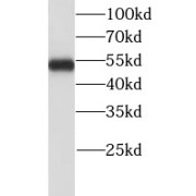 WB analysis of HepG2 cells, using LHX6 antibody (1/300 dilution).