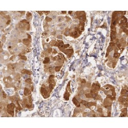 Lipoyl Synthase, Mitochondrial (LIAS) Antibody