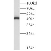 WB analysis of human brain tissue, using LIAS antibody (1/500 dilution).