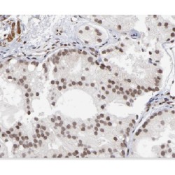 DNA Ligase 4 (LIG4) Antibody