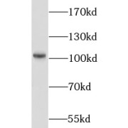 WB analysis of mouse testis tissue, using LIG4 antibody (1/600 dilution).