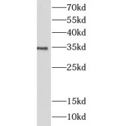 WB analysis of K562 cells, using LILRA5 antibody (1/300 dilution).