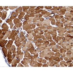 LIM Domain Kinase 1 (LIMK1) Antibody