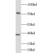 WB analysis of HeLa cells, using LIMK1 antibody (1/1000 dilution).