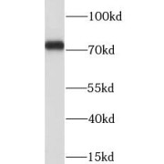 WB analysis of NIH/3T3 cells, using LIMK2 antibody (1/300 dilution).