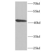 WB analysis of human kidney tissue, using LIMS1 antibody (1/1000 dilution).