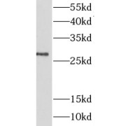 WB analysis of K-562 cells, using LIN28 antibody (1/300 dilution).