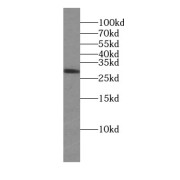 WB analysis of human heart tissue, using Lin28A-specific antibody (1/300 dilution).