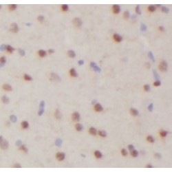 Lin28B-specific Antibody