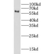 WB analysis of HEK-293 cells, using LIN9 antibody (1/300 dilution).