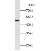 WB analysis of A549 cells, using LIPI antibody (1/300 dilution).