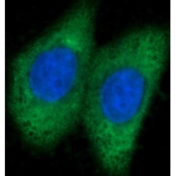 liver Arginase Antibody