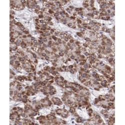 liver Arginase Antibody