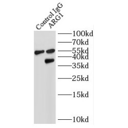 liver Arginase Antibody