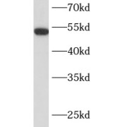 WB analysis of human brain tissue, using LMAN1 antibody (1/400 dilution).