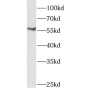 WB analysis of mouse testis tissue, using LMBR1L antibody (1/300 dilution).