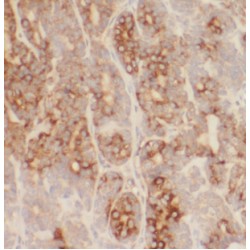 Lipase Maturation Factor 1 (LMF1) Antibody