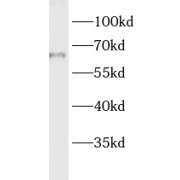 WB analysis of SKOV-3 cells, using LMF1 antibody (1/600 dilution).