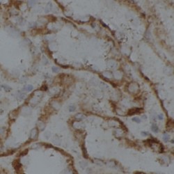 Lipase Maturation Factor 2 (LMF2) Antibody