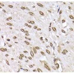 Lamin-B2 (LMNB2) Antibody