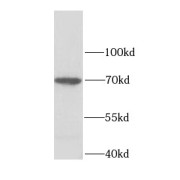 WB analysis of Jurkat cells, using LMNB2 antibody (1/1000 dilution).