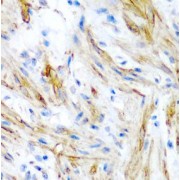 IHC analysis of paraffin-embedded human colon, using LMOD1 antibody (1/100 dilution).